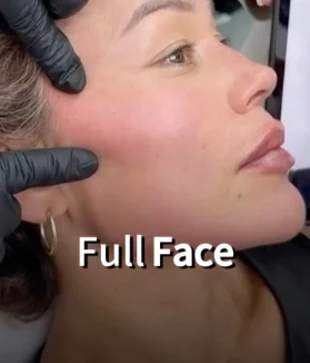Aesthetic full face