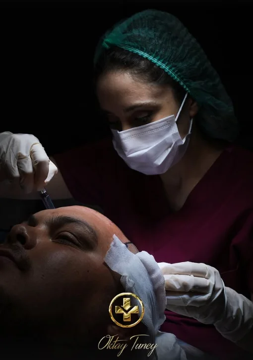 Hair transplant