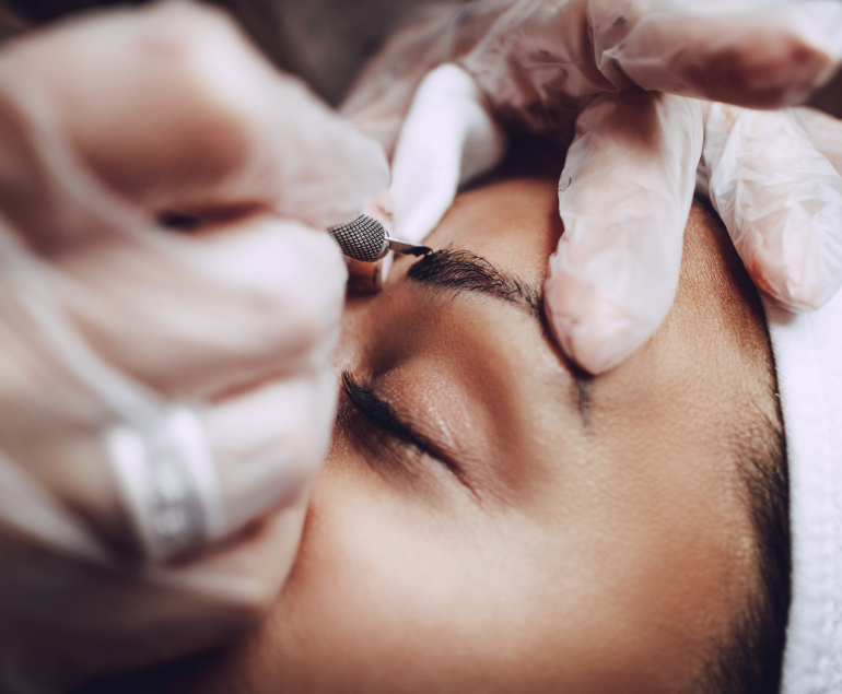 Eyebrow Lift