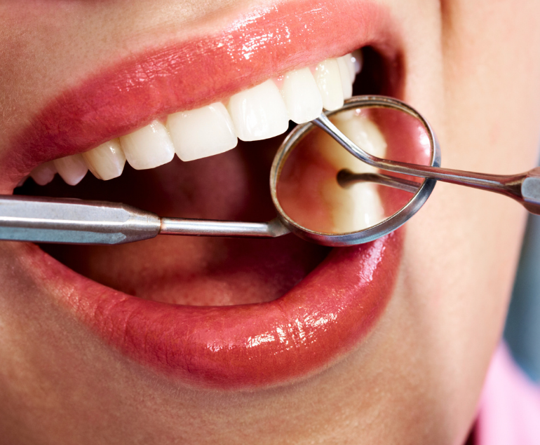 Dental Implant
