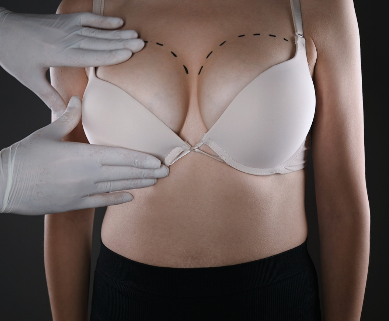 Chirurgia estetica del seno
